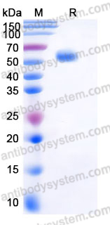 Recombinant Human TREM2 Protein, C-Fc (Active)