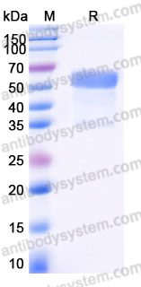 SDS-PAGE for Recombinant Human TREM2 Protein, C-mFc (Active) ?>