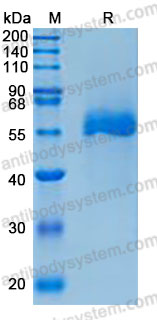 Recombinant Human SERPINA12 Protein, C-10*His (Active)