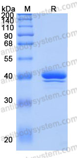 Recombinant Human NOTUM Protein, C-His (Active)