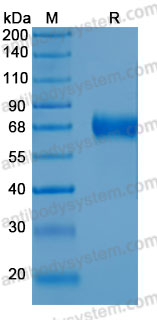 Recombinant Human CHST15 Protein, N-His (Active)