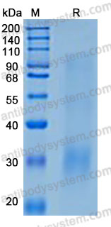 Recombinant Human CBLN2 Protein, N-His (Active)