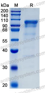 Recombinant Human NLGN4X Protein, C-His (Active)