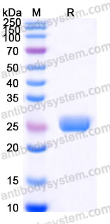 Recombinant Mouse CD254/RANKL/TNFSF11 Protein, N-His-Flag (Active)