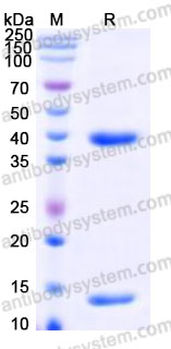 Recombinant Mouse MSTN/GDF8 Protein, N-His (Active)