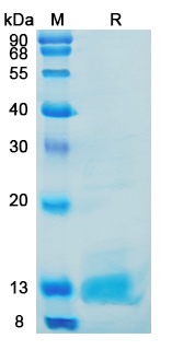 Recombinant Mouse C3/Complement C3 Protein, C-His (Active)
