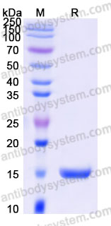 Recombinant Mouse PDGFB Protein, C-His (Active)