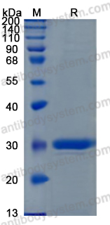 Recombinant Mouse Pentraxin/SAP Protein, C-10*His (Active)