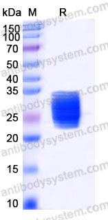 Recombinant Mouse IL6 Protein, N-His (Active)