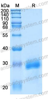 Recombinant Mouse MBL2/MBP-C Protein, C-His (Active)