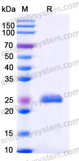 Recombinant Mouse IL7 Protein, C-His (Active)