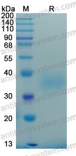 Recombinant Mouse OSM/Oncostatin-M Protein, C-His (Active)