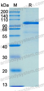 Recombinant Mouse HGF Protein, C-His (Active)