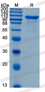Recombinant Mouse MMP9 Protein, C-His (Active)