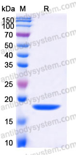 Recombinant Mouse LIF Protein, Tag free (Active)