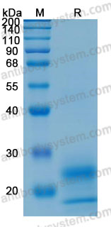 Recombinant Mouse CD252/TNFSF4/OX40L Protein, N-10*His (Active)