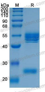 Recombinant Mouse IL12 Protein, C-His (Active)