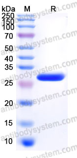 Recombinant Mouse FGF9 Protein, N-His (Active)
