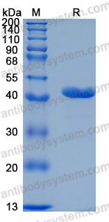 Recombinant Mouse CHI3L1 Protein, C-His (Active)