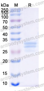 Recombinant Mouse Flt3 ligand/FLT3LG Protein, C-His (Active)