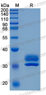 Recombinant Mouse KLK7 Protein, C-His (Active)