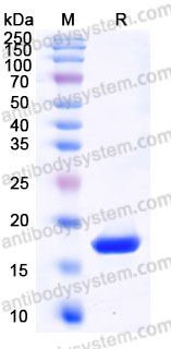 Recombinant Mouse IL2 Protein, Tag free (Active)