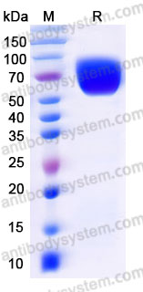 Biotinylated Mouse CD213a1/IL13RA1 Protein, C-Avi-His