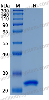 Recombinant Mouse LCN2/NGAL Protein, C-10*His (Active)
