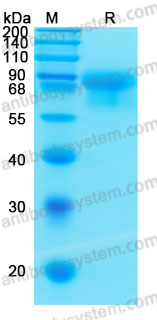 Recombinant Mouse CD215/IL15RA Protein, C-hFc-His (Active)