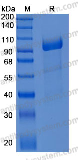 Recombinant Mouse ACE2 Protein, C-10*His (Active)