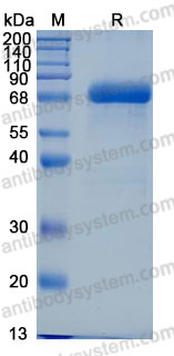 Recombinant Mouse IL23 Protein, C-His (Active)