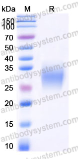Recombinant Mouse TREM2 Protein, C-His (Active)