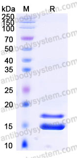 SDS-PAGE for Biotinylated Mouse ITPRIPL1 Protein, C-His-Avi ?>