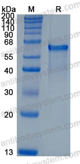 Recombinant Rat DLL1 Protein, C-His (Active)