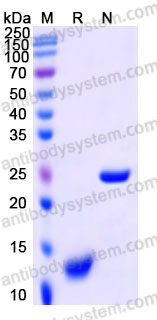 Recombinant Rat TGFB1/TGF-beta-1 Protein, Tag free (Active)