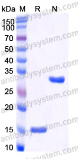 Recombinant Rat INHBA Protein, Tag free (Active)