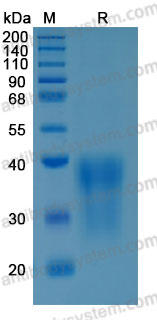 Recombinant Rat CCL2/MCP-1 Protein, C-His (Active)