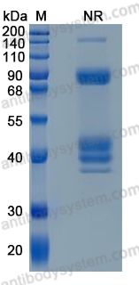 SDS-PAGE for Recombinant Rat IL12 Protein, C-His (Active) ?>