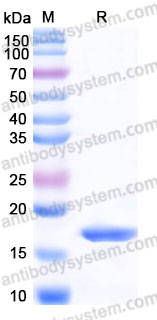 Recombinant Rabbit TNFa/TNF-alpha Protein, Tag free (Active)