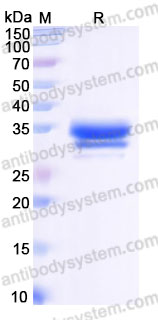 Recombinant Rhesus monkey TNFSF15/TL1A Protein, N-His-Flag (Active)