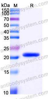 Recombinant Rhesus monkey IL33 Protein, N-His (Active)