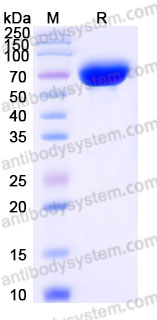 Recombinant Rhesus monkey CD126/IL6R/IL-6RA Protein, C-His (Active)