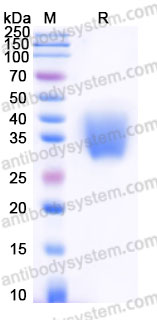 Recombinant Cynomolgus monkey CD28 Protein, N-His (Active)
