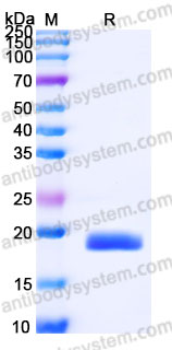 Recombinant Cynomolgus monkey IL17F Protein, C-His (Active)