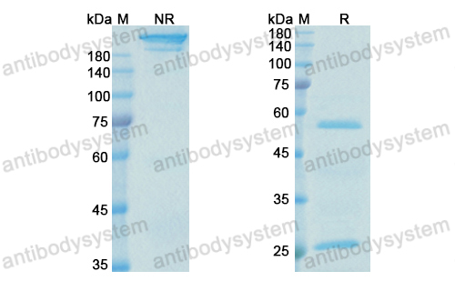 Research Grade Anti-Human IL4 Antibody (VAK-694)