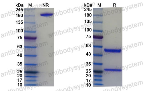 SDS-PAGE for Research Grade Laventatug ?>