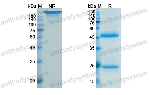 Research Grade Anti-Dog IL31 Antibody (SAA1416)