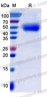 Recombinant Human CD172b/SIRPB1 Protein, C-His