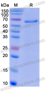 Recombinant Human DLL1 Protein, C-His
