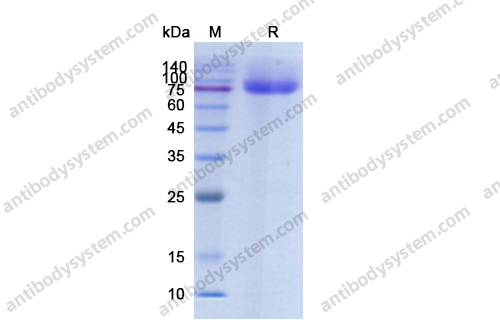 Recombinant Human CD304/NRP1 Protein, C-His